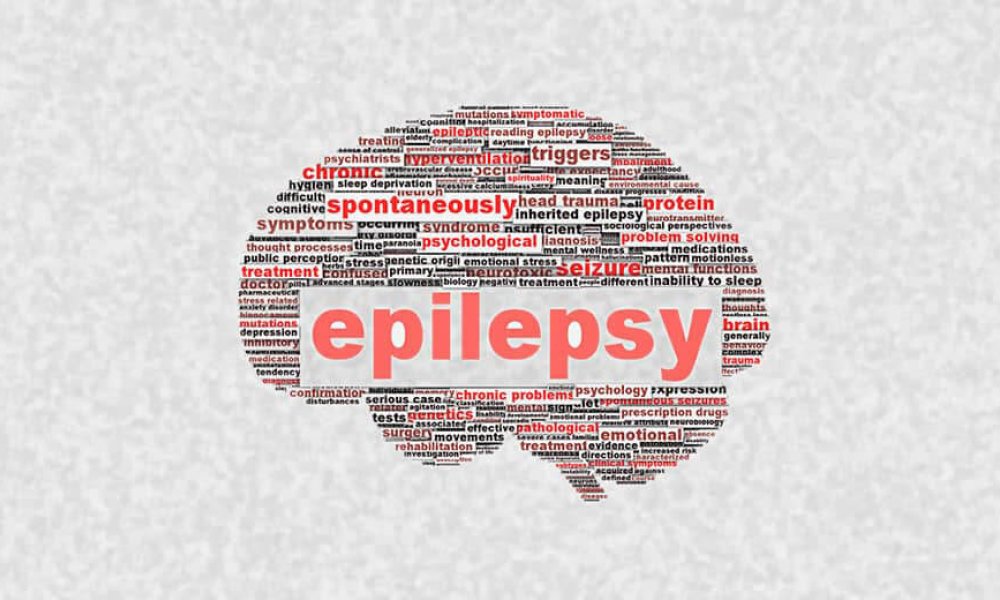 Epilepsi nöbet sırasında yapılması gerekenler?